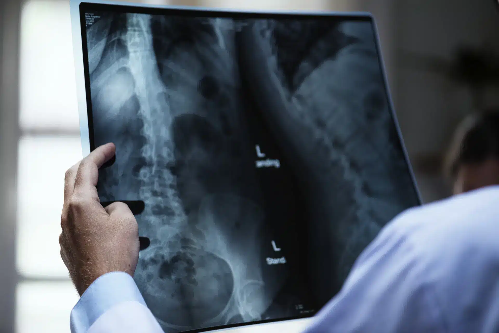 Spinal Cord Injury Lawyer Image