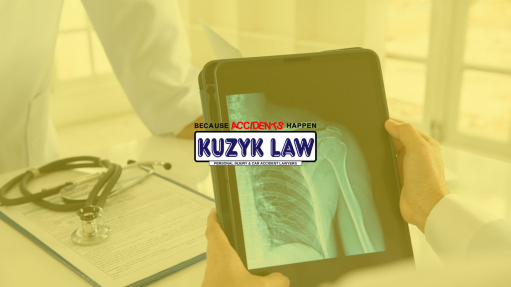 Fresno Broken Bones Lawyer