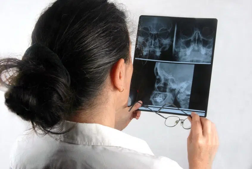 Head Injury Seek Treatment Immediately