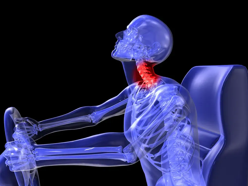 Lancaster Neck Injury Lawyer