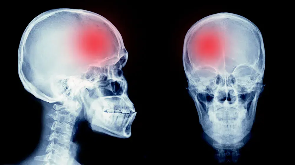Shutterstock Skull
