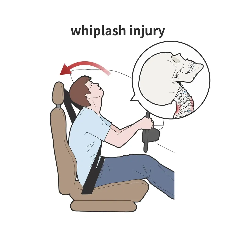whiplash-injury-accident
