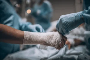 Bakersfield Burn Injury Lawyer